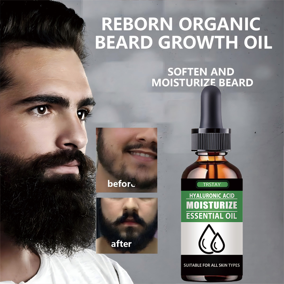Men'S Grooming Tonic - 100%Natural Accelerate Facial Hair Grow Beard